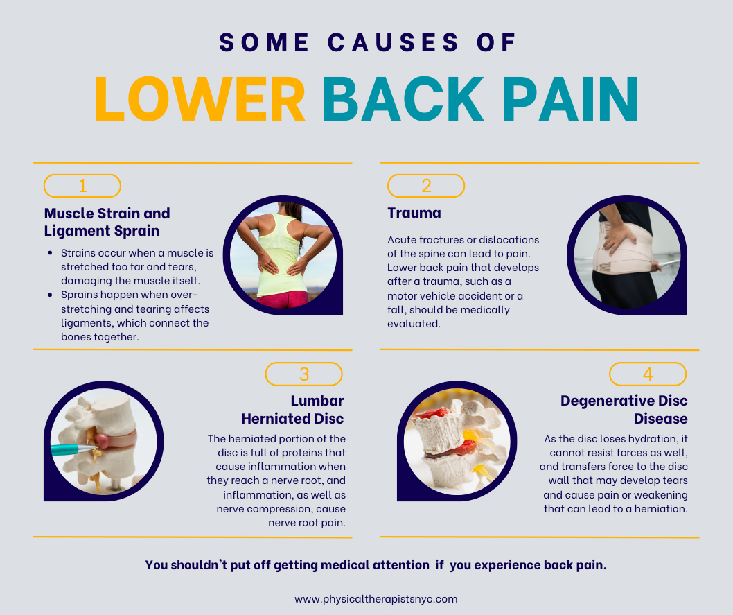 Physical Therapy for Lower & Upper Back Pain : Physical Therapists NYC