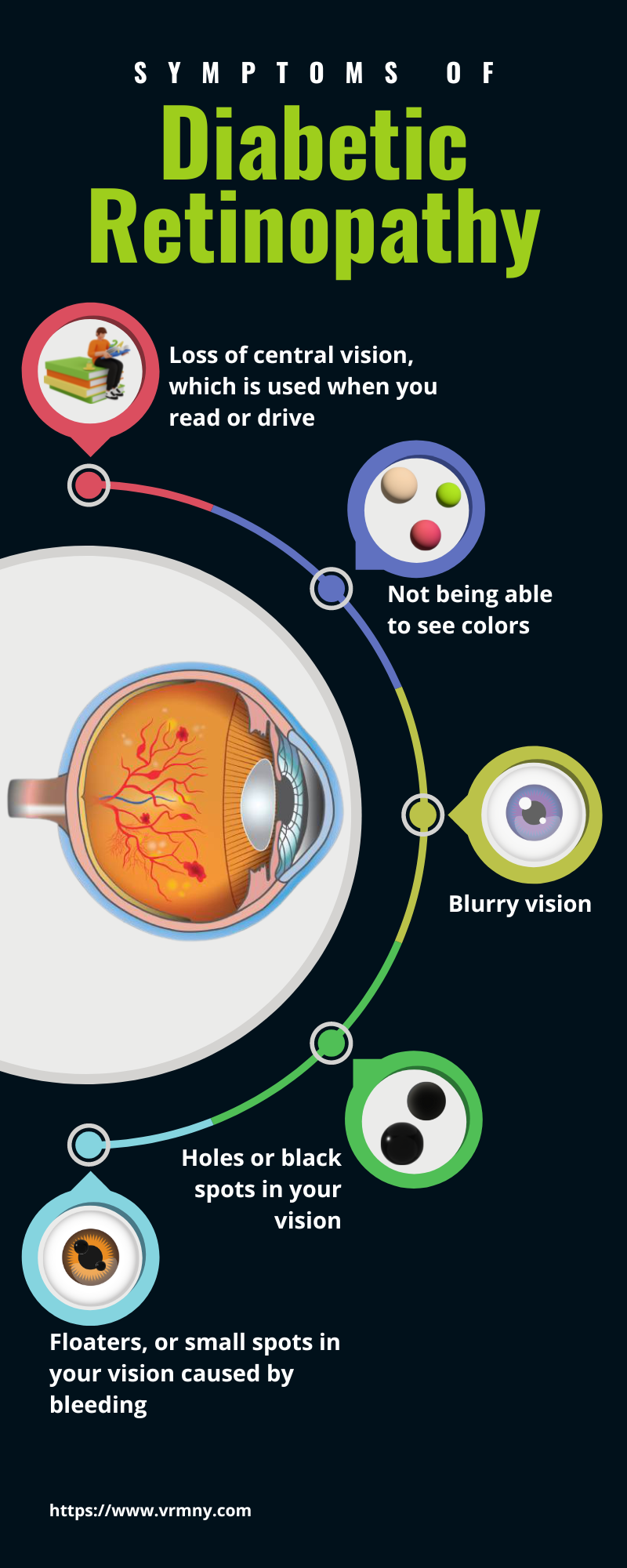 Macular Hole : Vitreous Retina Macula Consultants of New York